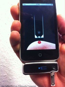 Das iPhone als Blutzuckermessgerät